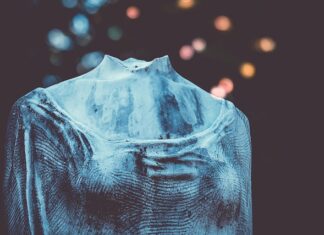 Czy można jeździć z uszkodzona podpora wału?